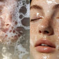 Double cleansing: Prečo je dvojfázové čistenie pleti kľúčom k zdravej pokožke