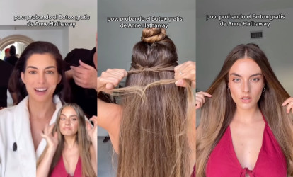 Mini vrkoče ako lifting tváre: Trik Anne Hathaway bez botoxu