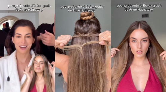 Mini vrkoče ako lifting tváre: Trik Anne Hathaway bez botoxu