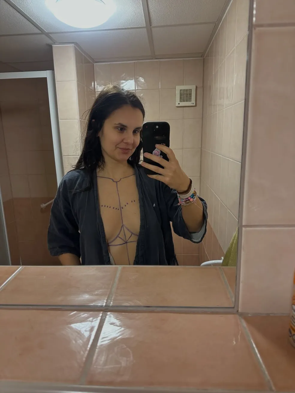 genetická mutácia BRCA1