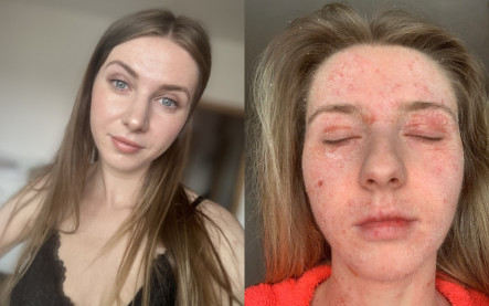 Nikol Macháčková rozhovor