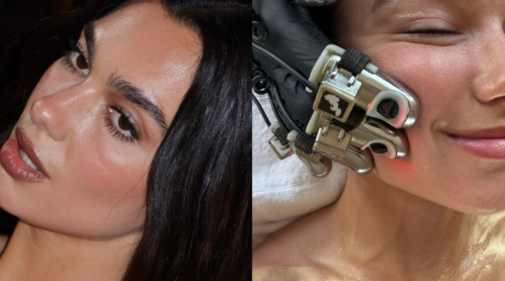 Ako si Dua Lipa udržiava žiarivú pleť? Facialistka Alessandra Ricchizzi odhaľuje techniky