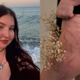 Karin Skopcová otvorene o Crohnovej chorobe: „Bála som sa, že prídem o svoj život. A vlastne sa to aj stalo.“
