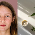 Marihuana a pleť: Môže THC spôsobovať akné, vrásky a zhoršiť stav pokožky?