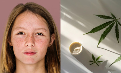 Marihuana a pleť: Môže THC spôsobovať akné, vrásky a zhoršiť stav pokožky?