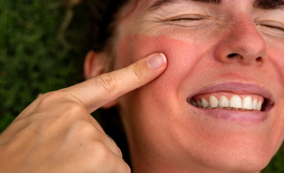 večerná skincare rutina po opaľovaní