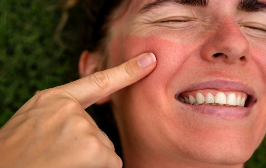 večerná skincare rutina po opaľovaní