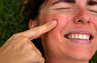 Večerná skincare rutina po opaľovaní: Ako efektívne upokojiť a hydratovať pleť?