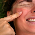 Večerná skincare rutina po opaľovaní: Ako efektívne upokojiť a hydratovať pleť?