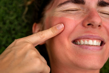 Večerná skincare rutina po opaľovaní: Ako efektívne upokojiť a hydratovať pleť?