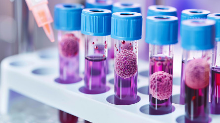 Tekutá biopsia: Revolúcia v diagnostike rakoviny? AI dokáže odhaliť nádor z krvi