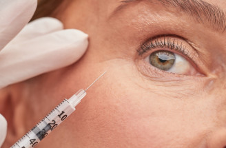 Polynukleotidy pod oči: Čo dokážu s kruhmi a vráskami a kedy sú lepšie než výplň?