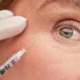 Polynukleotidy pod oči: Čo dokážu s kruhmi a vráskami a kedy sú lepšie než výplň?