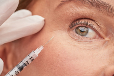 Polynukleotidy pod oči: Čo dokážu s kruhmi a vráskami a kedy sú lepšie než výplň?