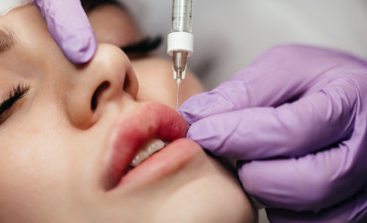 Lip flip: rozdiel oproti výplni pier, limity a riziká