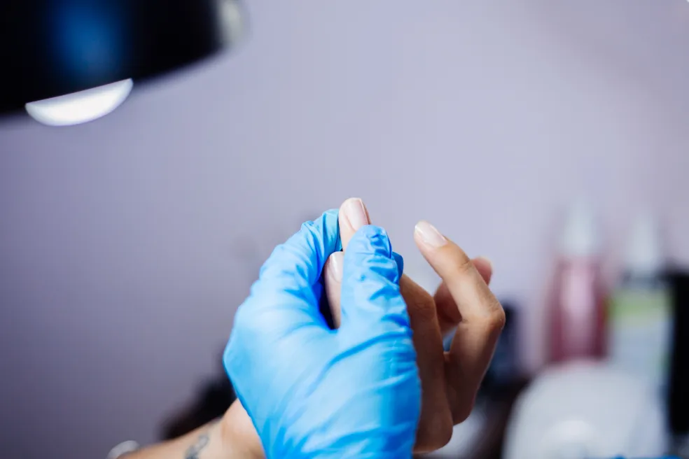 Dermatológ vyšetruje nechty s bielymi škvrnami a zmenami nechtovej platničky