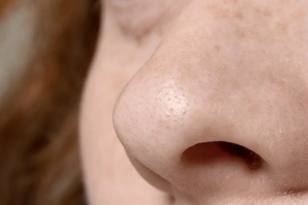 Detail nosa s viditeľnými pórmi a drobnými tmavými bodkami, ktoré môžu predstavovať prirodzené mazové filament